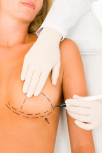 Breast Reduction Before and After Photos - Las Vegas